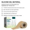 3 Meters Silicone Scar Stickers to Reduce Itching and Redness