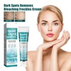 Aufhellende Sommersprossen Creme,Dark Spot Remove,Anti-Freckle Niacinamide Cream,Neu Skin Whitening Cream