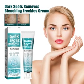 Aufhellende Sommersprossen Creme,Dark Spot Remove,Anti-Freckle Niacinamide Cream,Neu Skin Whitening Cream mit Vitamin C gegen Dunkle Flecken,Aufhellungscreme für Ebenmäßig Strahlenden Teint,20ML