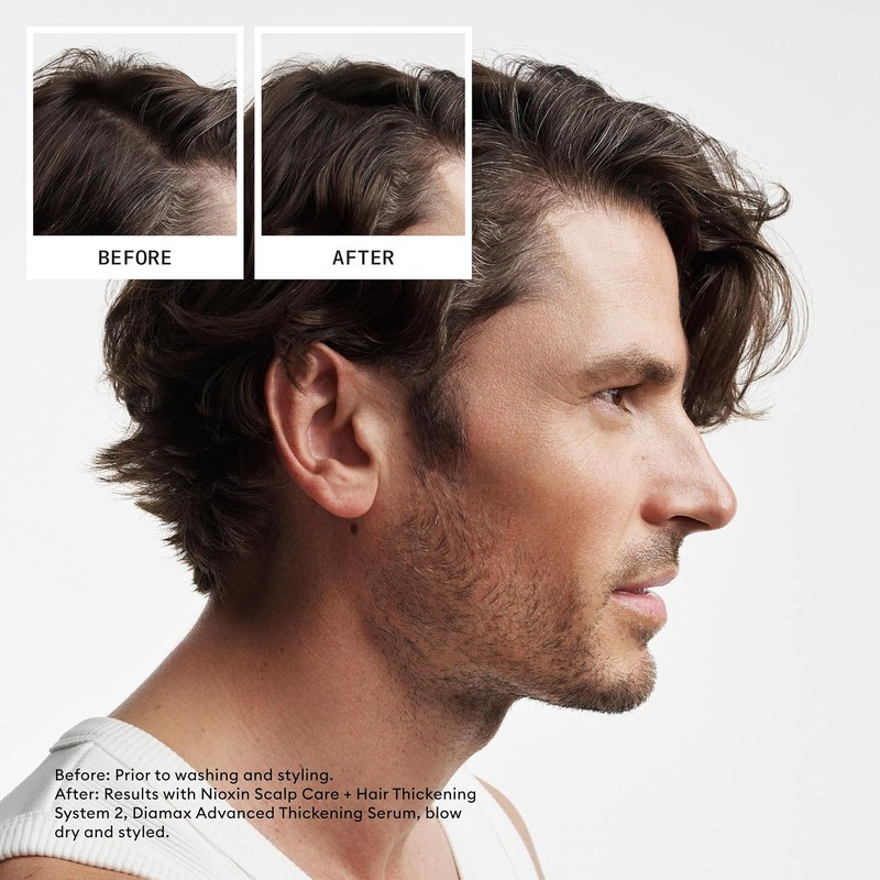 Nioxin Cleanser Shampoo System 2 for Fine Hair with Progressed