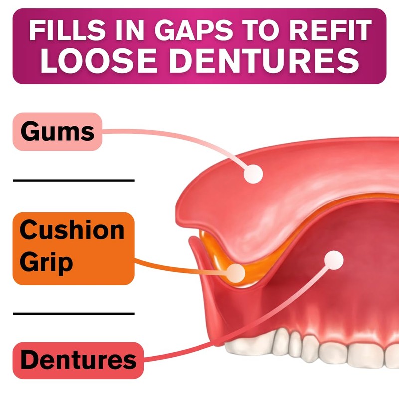 Cushion Grip Thermoplastic Denture Adhesive 1 oz (5-Pack) – Refits