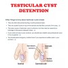 ORGANIC VITAMINS QUISTE TESTICULAR ROMOVEDOR - NO MAS DOLOR -