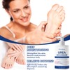 Urea Cream, Urea Cream 60 Percent, Foot Cream Urea, Repair