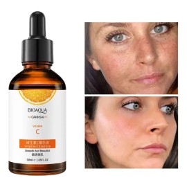 Suero Vitamina C Bioaqua Blanqueador Reparacion Cuidado Piel Tipo De Piel Todo Tipo De Piel