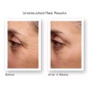 RETINOL VITAMIN A 5% + HYALURONIC ACID + Vitamin E