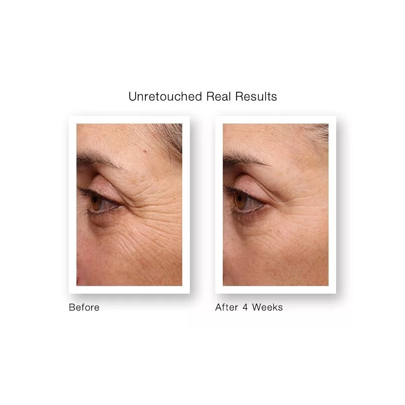 RETINOL VITAMIN A 5% + HYALURONIC ACID + Vitamin E