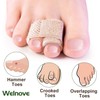 Mcvcoyh Broken Toe Wraps 6 Pack Cushioned Bandages Hammer Toe