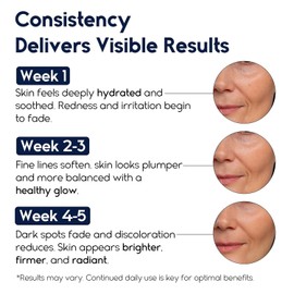 Hyaluronic Acid Serum for Face - 2.5% + B5 3% Ashido Hyaluronic Acid for Women Moisturizing Formula for Anti-Fine Lines Wrinkles and Aging 30ml Hyaluronic Acid Serum / 얼굴용 히알루론산 세럼 - 2.5% + B5 3% 여성용 아시도 히알루론코 잔주름 주름 및 노화 방지를 위한 보습 포뮬러 30ml Hyaluronic Acid Serum