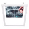 MMC-INGENIERIA MEDICA Negatoscopio Dental Led 30 X 30 Ultra Slim