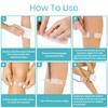 ViveCare Emergency Wound Closure Device Kit 4 Pcs - Adhesive
