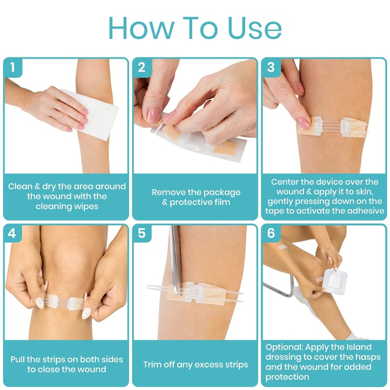 ViveCare Emergency Wound Closure Device Kit 4 Pcs - Adhesive