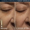 RoC Retinol Correxion Deep Wrinkle Repair Pack