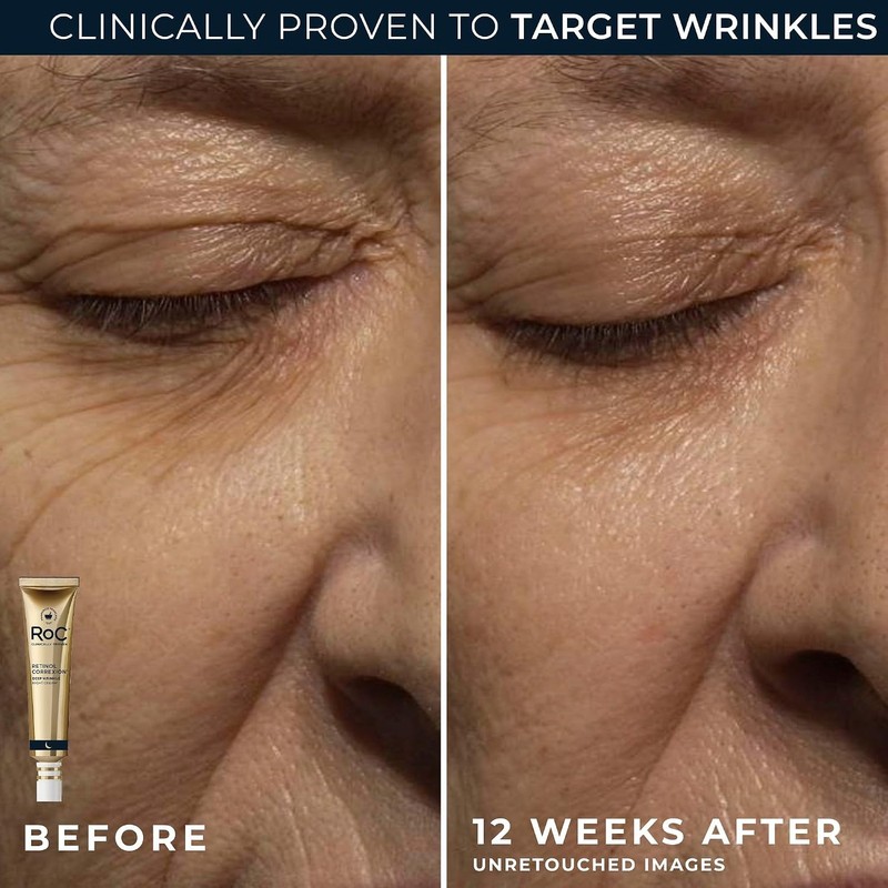 RoC Retinol Correxion Deep Wrinkle Repair Pack