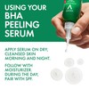 Vichy Normaderm BHA Peeling Serum with Salicylic Acid & Glycolic