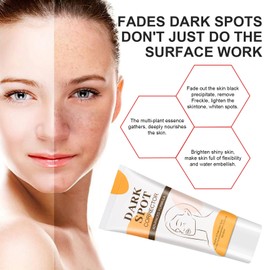 Tkekruh 2PC Sommersprossen Creme 60ml, Aufhellende Creme, Gesichtscreme Gegen Dunkle Flecken, Anti Pigmentflecken Gesicht, Whitening Cream, Flecken Creme, Altersflecken Creme, Pigmentflecken Entferner