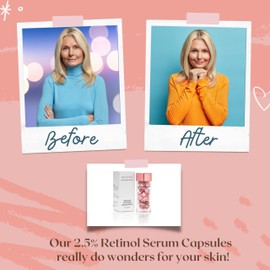 Turbinne Pure 2.5% Retinol Serum Capsules. Look 5 Years Younger In 30 Days. Powerful Anti -Aging, Deep Hydration, Brightening, Reduce Acne, Dark Spots & Wrinkles (Pack of 4)