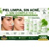 Kit Skincare Antiacné Vogirlog 5 Pasos Control Grasa