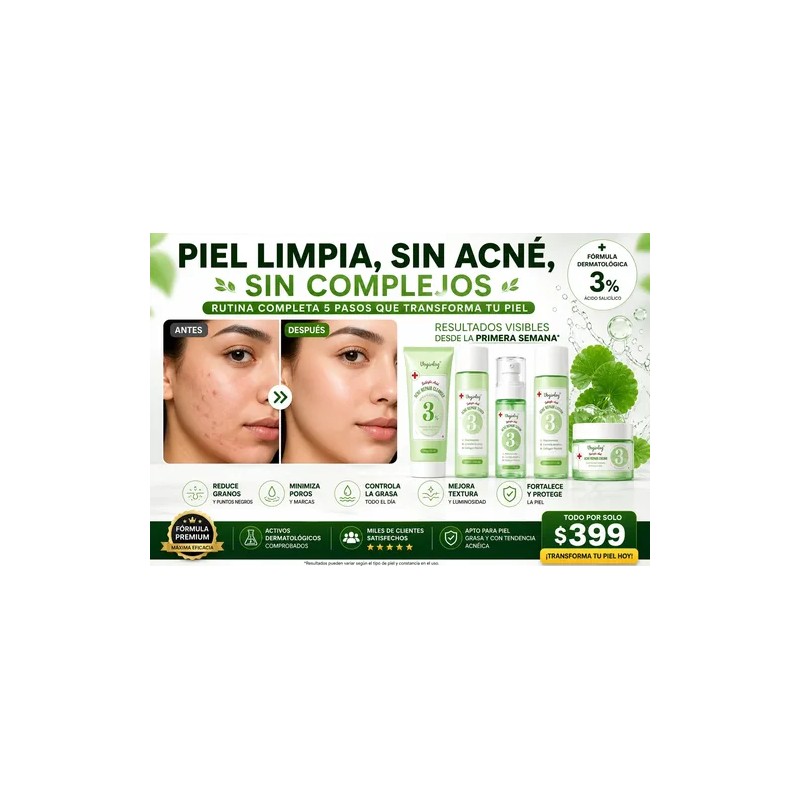 Kit Skincare Antiacné Vogirlog 5 Pasos Control Grasa