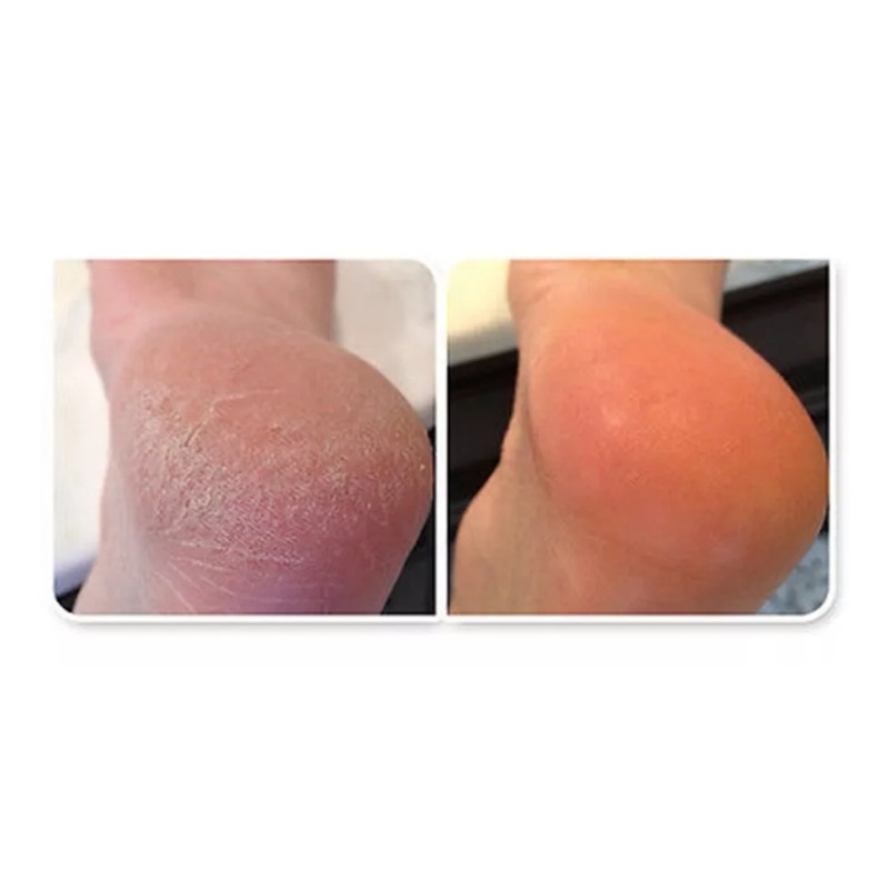 Spaesthetic Urea Al 10% En Gel-crema Hidratante 500 Ml