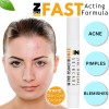Bálsamo Para Imperfecciones Con Zinc Tratamiento Acné 2g