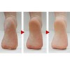 LUPO Callus Remover Callus Callus Remover Tool Foot Heel Razor