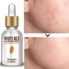 Ácido Hialuronico Suero Serum De Arroz Suero Vitamina C