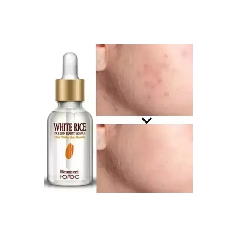 Ácido Hialuronico Suero Serum De Arroz Suero Vitamina C