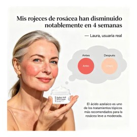 Crema Con Ácido Azelaico Al 20% Niacinamida Y Vitamina C