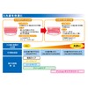 tahugurippukusshon Transparent, Dentures, Stabilizers (Total, Dentures, and part, Dentures,) G