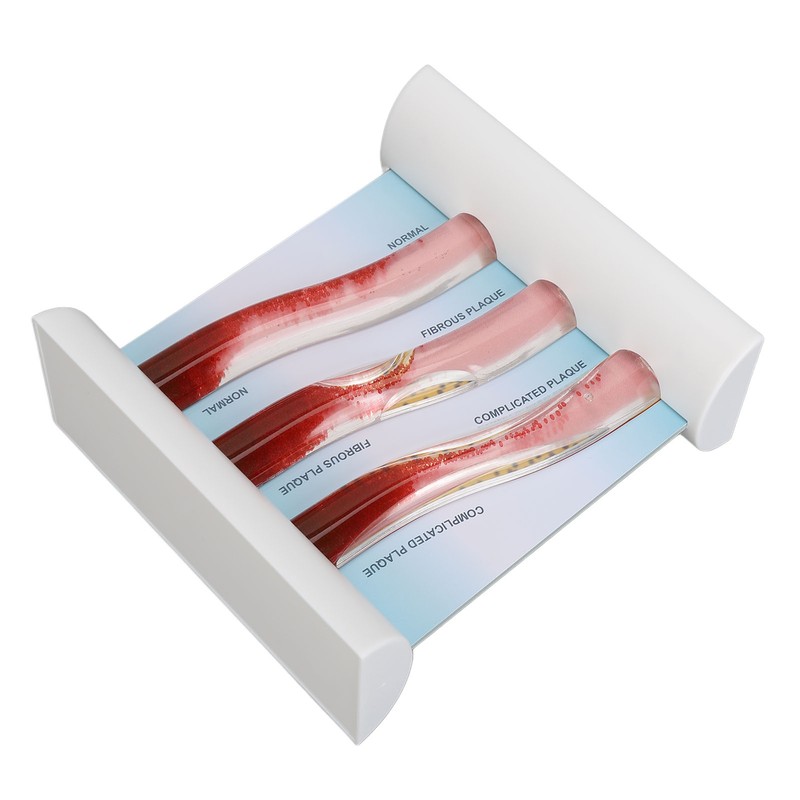 Lipoprotein LDL Blood Vessel Model Low Density Blood Lipid Vessel