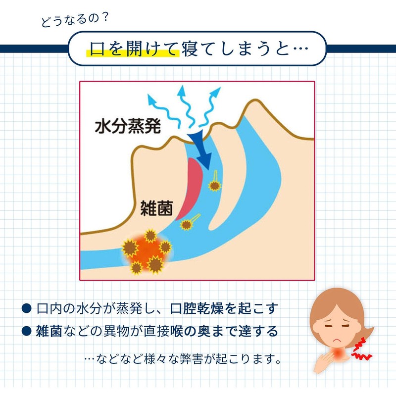 コモライフ 寝るとき貼るだけグッスリップ2 日本製 36枚入り(1シート4枚×9枚) 鼻呼吸テープ 安眠グッズ 乾燥 いびき 軽減 防止