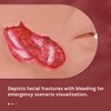 Simedutech Facial Trauma Model, Bleeding Face, Comprehensive Wearable Facial Pathology