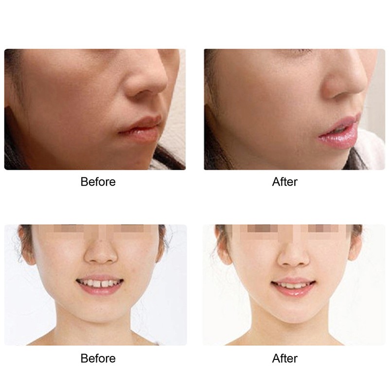 Face Lifting Band V Line Elastic Graphene Breathable Adjustable Face