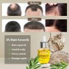 Aceite Capilar Giofna Rosemary Serum Para Cabello Encrespado