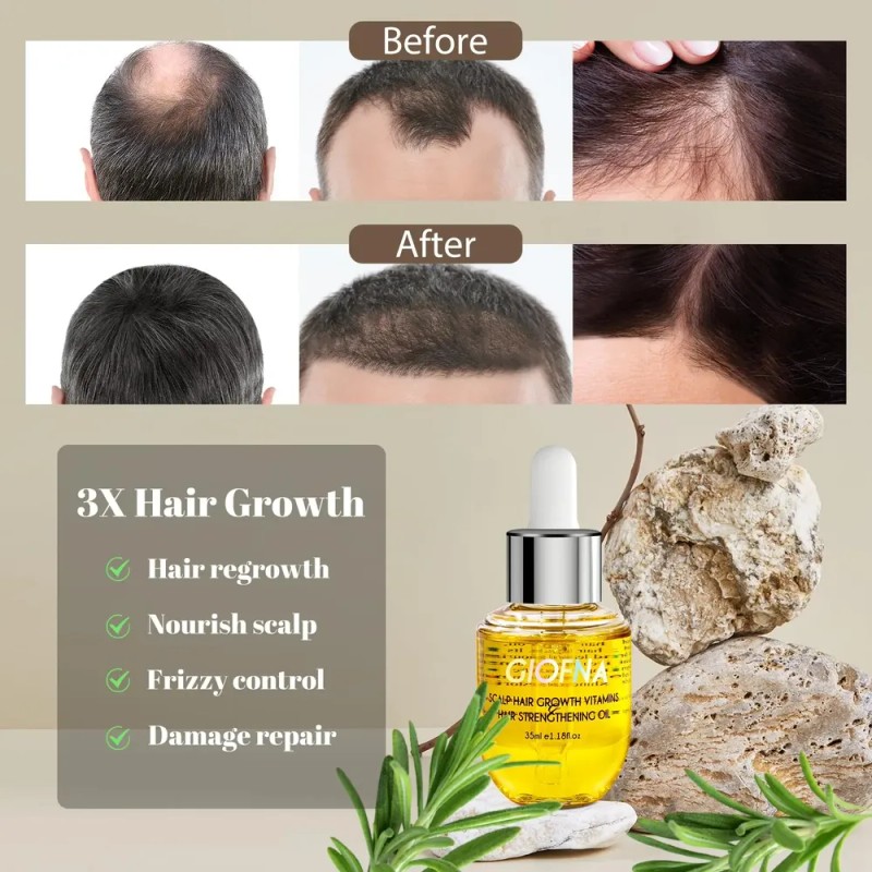 Aceite Capilar Giofna Rosemary Serum Para Cabello Encrespado