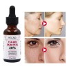. 30 Ml De Tca Aid Exfoliante Para La Piel,