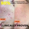 Glow Hub The Scar Slayer Facial Serum with Vitamin C