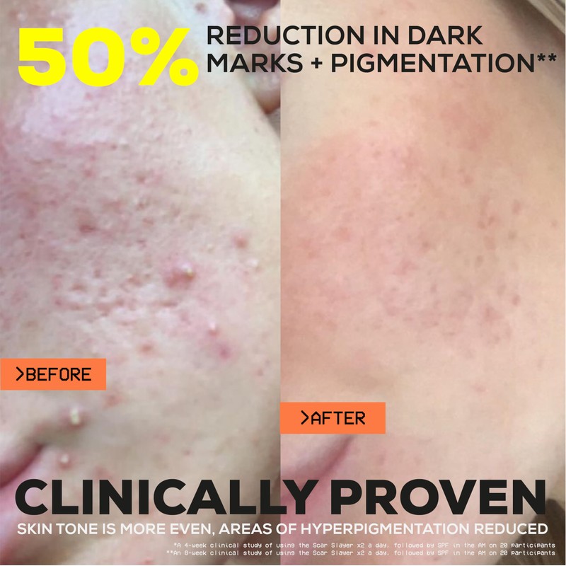 Glow Hub The Scar Slayer Facial Serum with Vitamin C