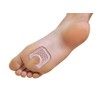 PediFix #P8203 Foot Gel Pad, Corn & Octopus, Pack of