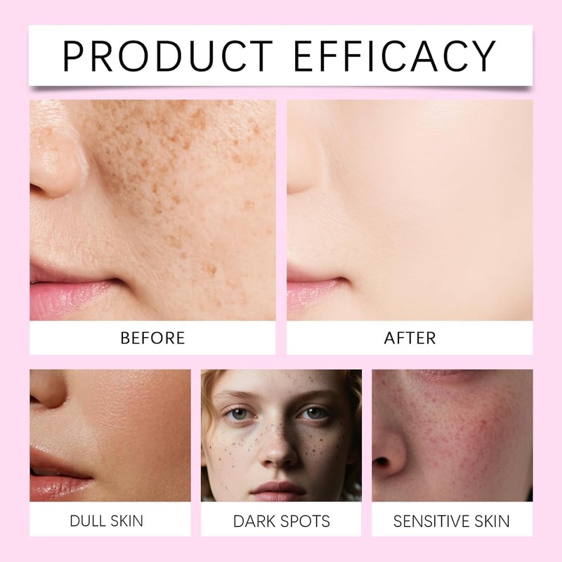 (Most Gifted) New 1/2/3PCS 𝐀𝐫𝐛𝐮𝐭𝐢𝐧𝐚 𝟕% + 𝐀́𝐜𝐢𝐝𝐨 𝐓𝐫𝐚𝐧𝐞𝐱𝐚𝐦𝐢𝐜𝐨 𝟒%