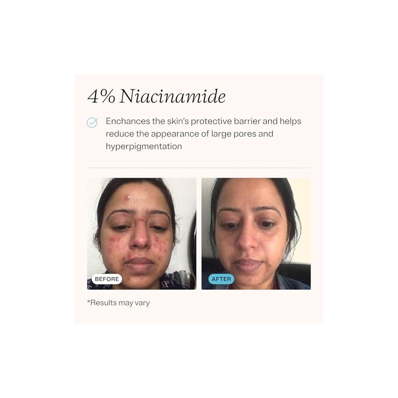 MDacne Retinol 0.25 y Niacinamida 2 Crema de tratamiento, reduce