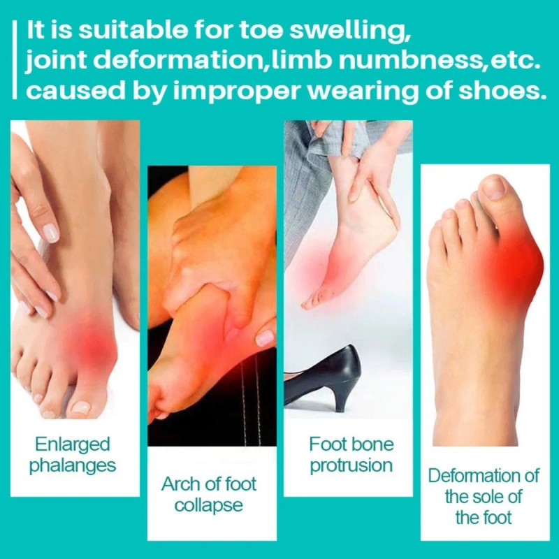 Pomada Para El Dolor Pomada Para El Reumatismo Pomada