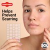 36pk Spot & Cold Sore Patches | 12pcs 8mm &