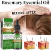 Aceite Natural de Romero para Crecimiento del Cabello