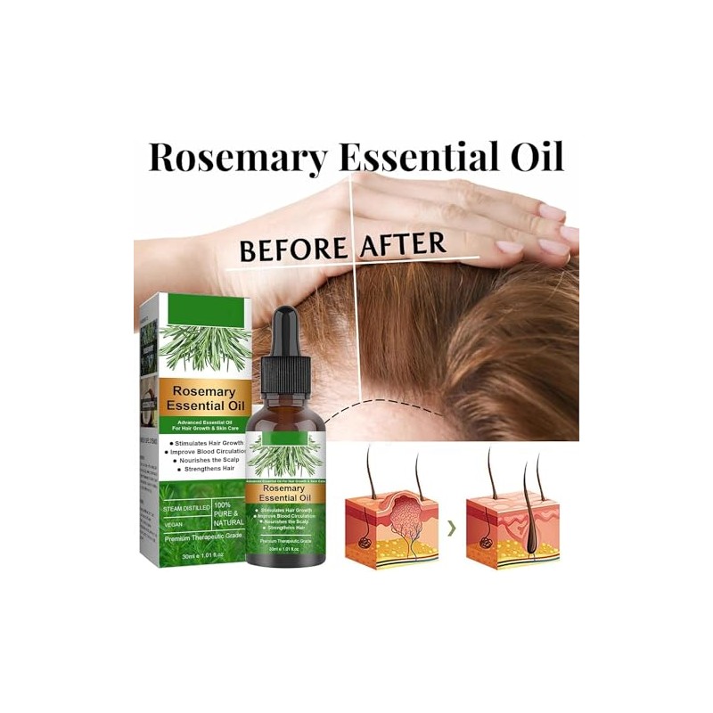 Aceite Natural de Romero para Crecimiento del Cabello