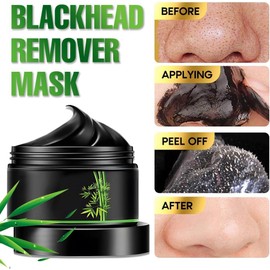 Kit de Mascarilla Eliminadora de Puntos Negros de Carbón Despegable Limpieza Profunda, Para Cara, Nariz, Poros y Acné, Todo Tipo de Piel