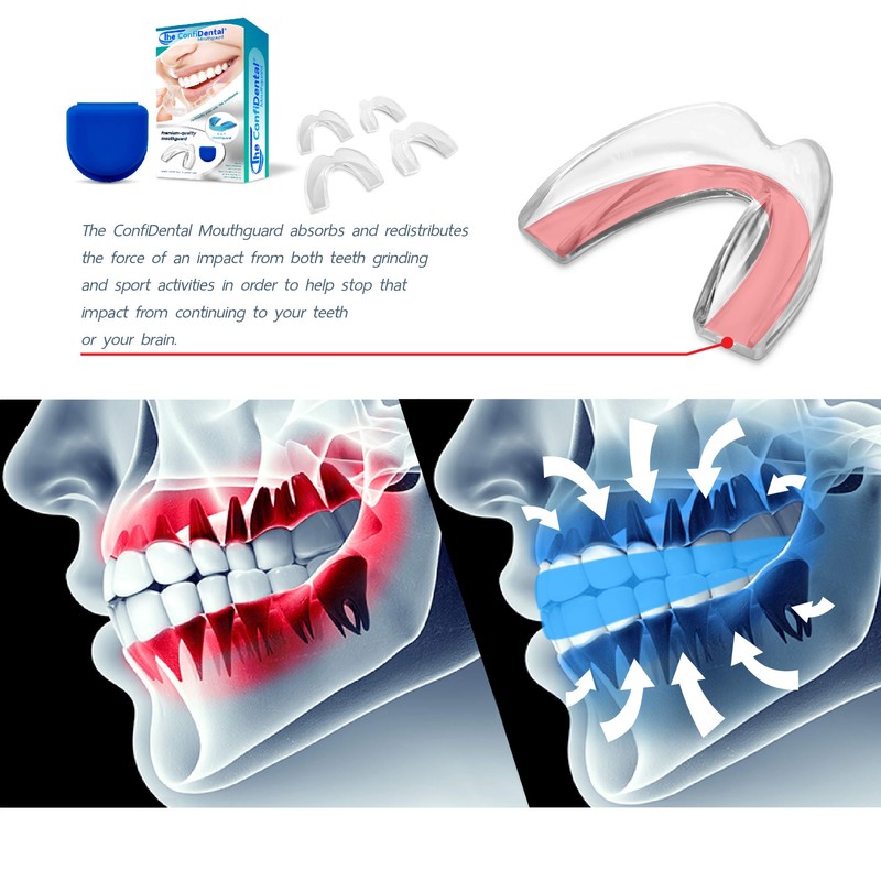 The ConfiDental - 2 Sizes, Pack of 8 Moldable Mouth