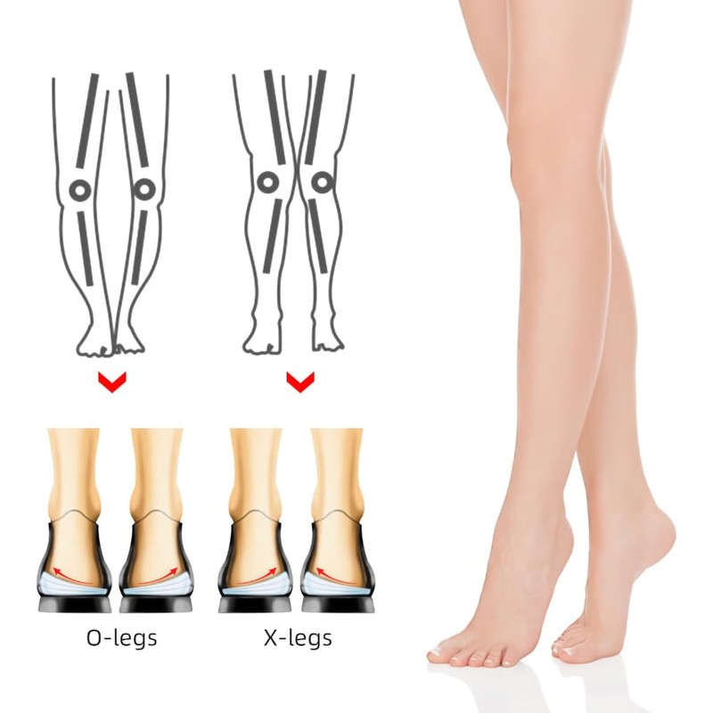 Two Pairs Overpronation Insoles,3 Layers Adjustable Heel Wedge Corrective Inserts,Correct