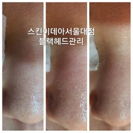 Cleane 2 Galvanic Ultrasonic Peeling Machine + Blackhead Toner + 100 Cotton Pads + 6 Sheet Packs (Sebum, Dead Cell, Pores Clear) Cleane Galvanic Ultrasonic Peeling Machine Giveaway / 클리네2 갈바닉 초음파필링기+블랙헤드토너+화장솜100매+시트팩6종(피지 각질 모공클리어) 클리네 갈바닉 초음파 필링기 증정품