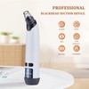 Xamoca Blackhead Remover Vacuum - Powerful Pore Vacuum for Cleansing,